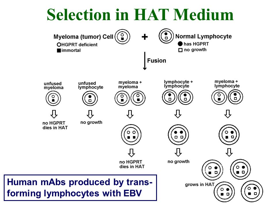 Hat selection sale